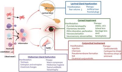 Recent advances in ocular graft-versus-host disease